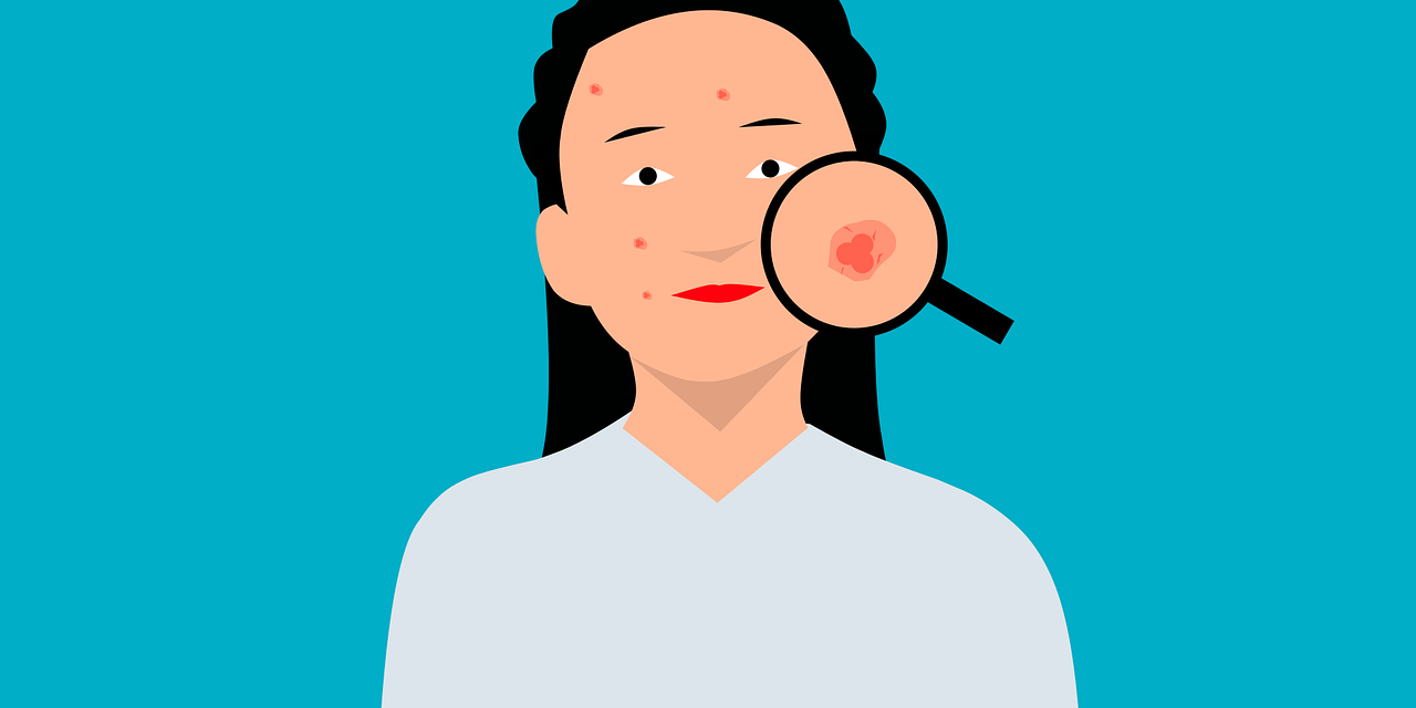 Dermatitas-1280×640 Dermatitas