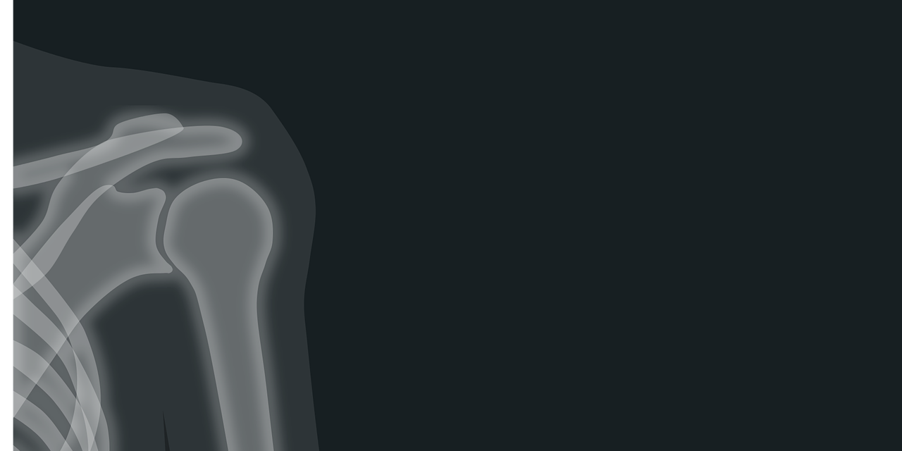 Peties sąnario artrozė